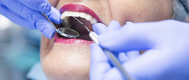 Best Cracked Tooth Emergency Dentist  in Kendall, FL